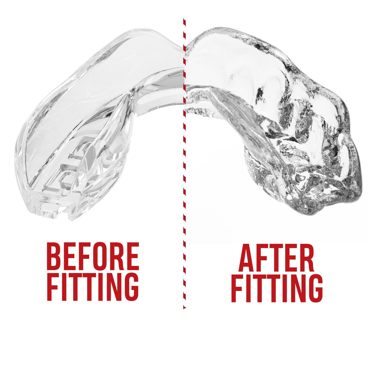 SAFEJAWZ Intro prozirni štitnik za zube