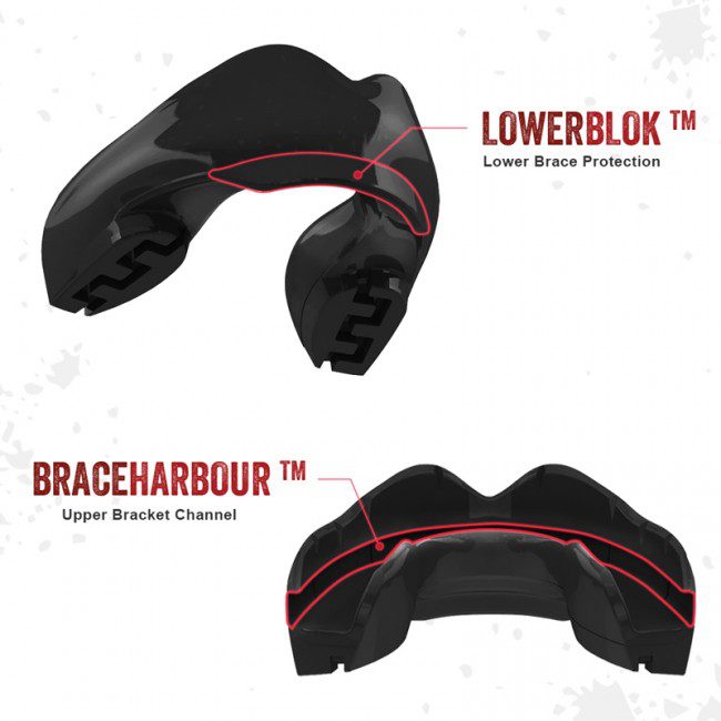 SAFEJAWZ Black ščitnik za zobe za tiste z zobnim aparatom