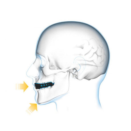 Shock Doctor® Gel Max Orange ščitnik za zobe