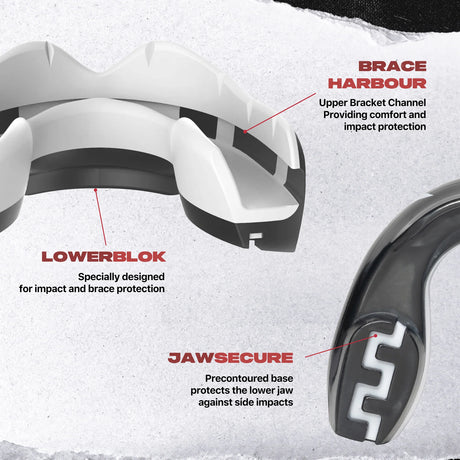 SAFEJAWZ Fangz Ščitnik Za Zobe Za Tiste Z Zobnim Aparatom