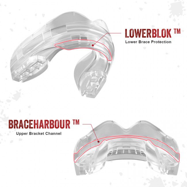 SAFEJAWZ Transparent ščitnik za zobe za tiste z zobnim aparatom