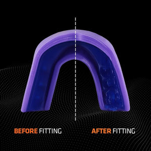 Shock Doctor Gel Strike Miami Purple Mouthguard
