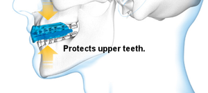 Shock Doctor® Braces ščitnik za zobe - za aparat